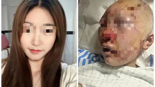 公厕被打女子:没有衣着暴露（公厕女孩）